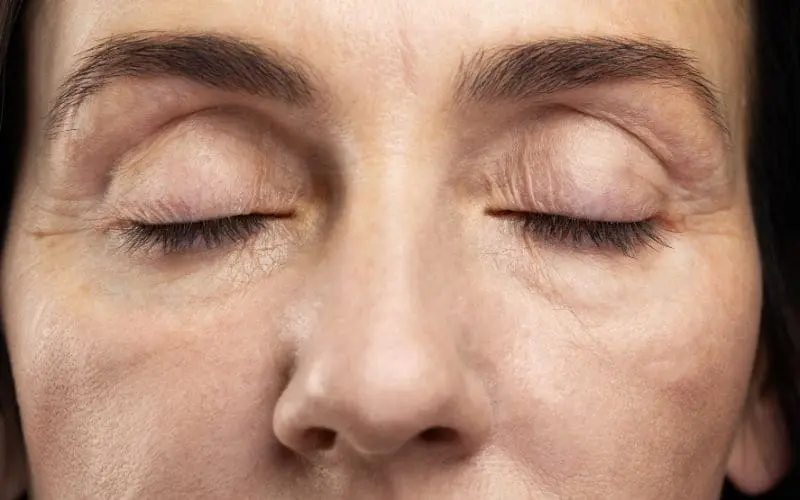rostro ozempic