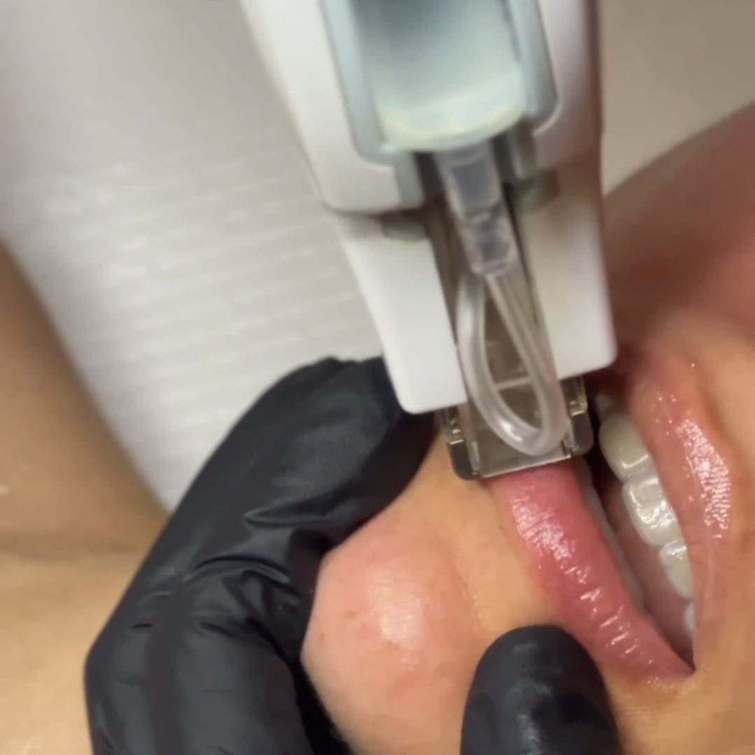 tratamiento hydralips para labios secos y agrietados